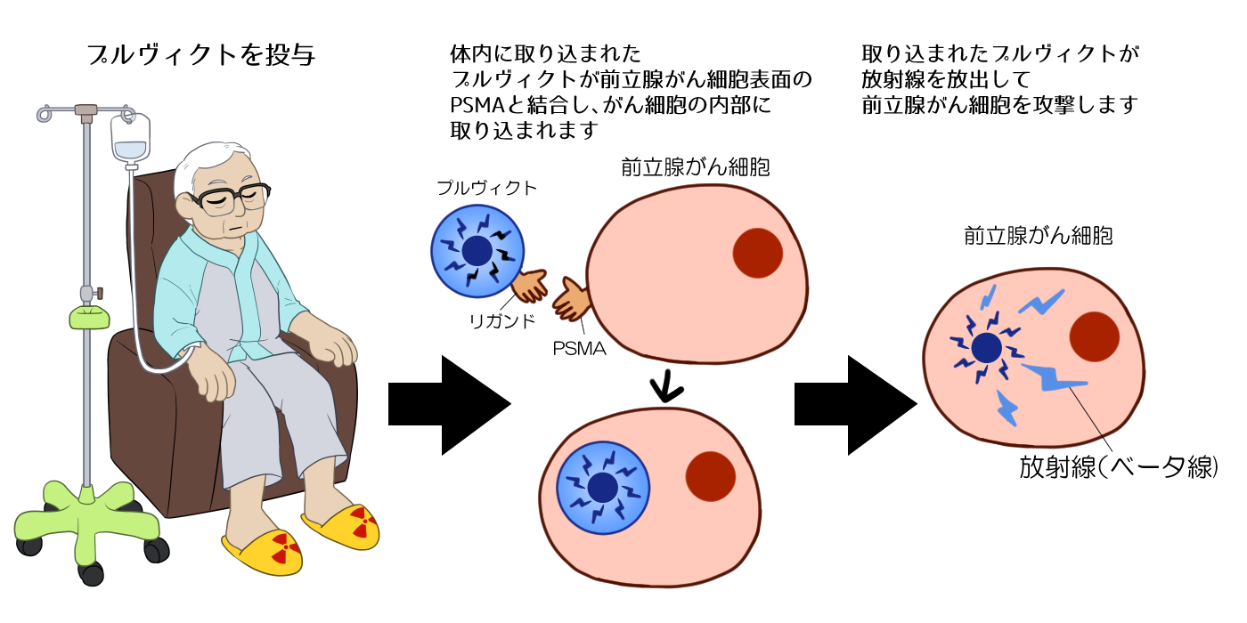 プルヴィクトの作用